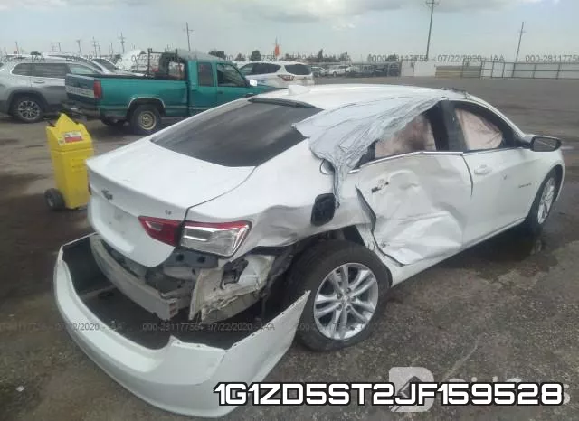 1G1ZD5ST2JF159528 фото 7