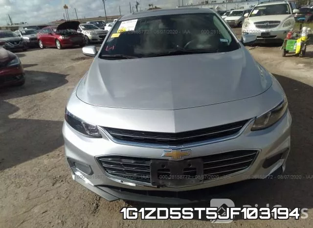 1G1ZD5ST5JF103194 фото 6