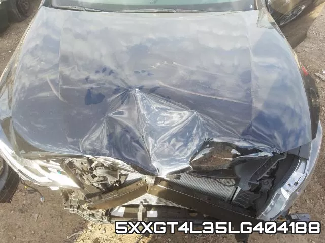 5XXGT4L35LG404188 фото 6