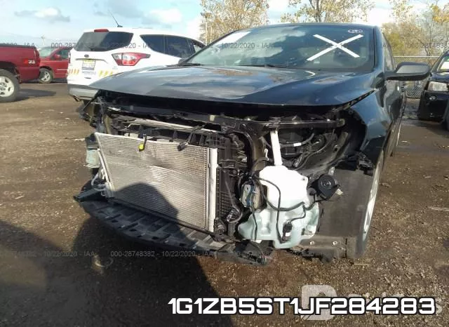 1G1ZB5ST1JF284283 фото 7