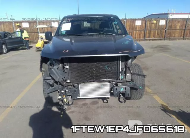 1FTEW1EP4JFD65618 фото 7