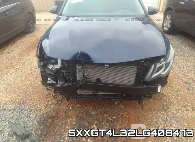 5XXGT4L32LG408473 фото 5