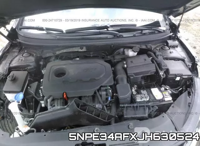 5NPE34AFXJH630524 фото 2