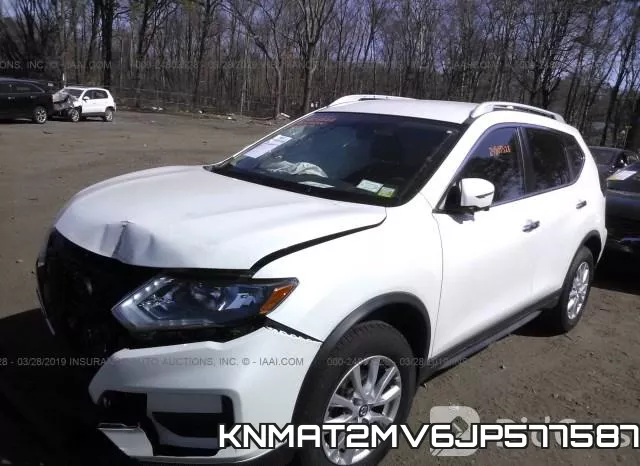 KNMAT2MV6JP577587 фото 3