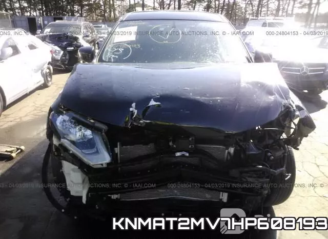KNMAT2MV7HP608193 фото 6