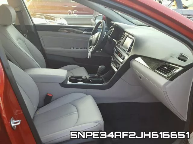 5NPE34AF2JH616651 фото 6