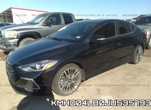KMHD04LB0JU535793 фото 3