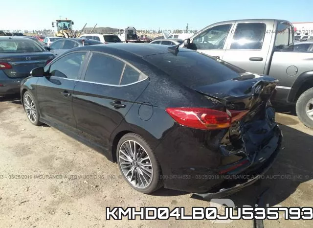 KMHD04LB0JU535793 фото 4