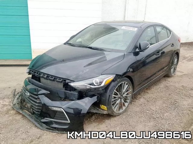 KMHD04LB0JU498616 фото 3