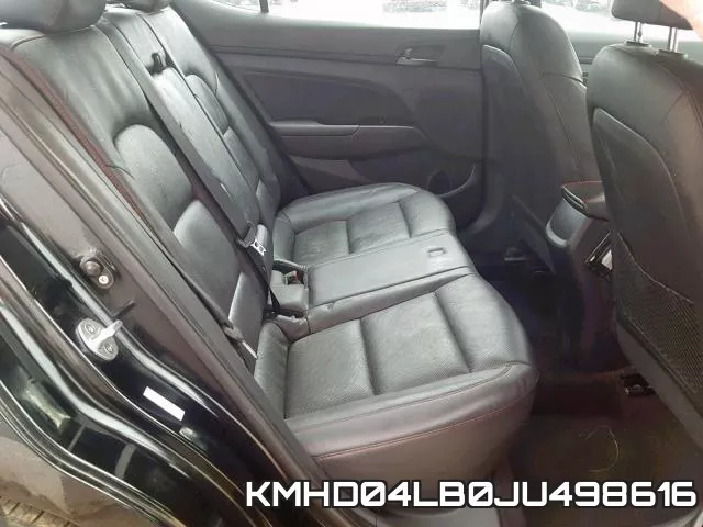 KMHD04LB0JU498616 фото 7