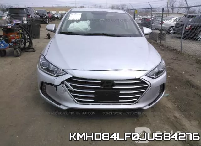 KMHD84LF0JU584276 фото 7