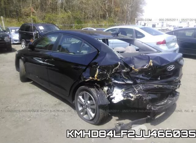 KMHD84LF2JU466035 фото 4