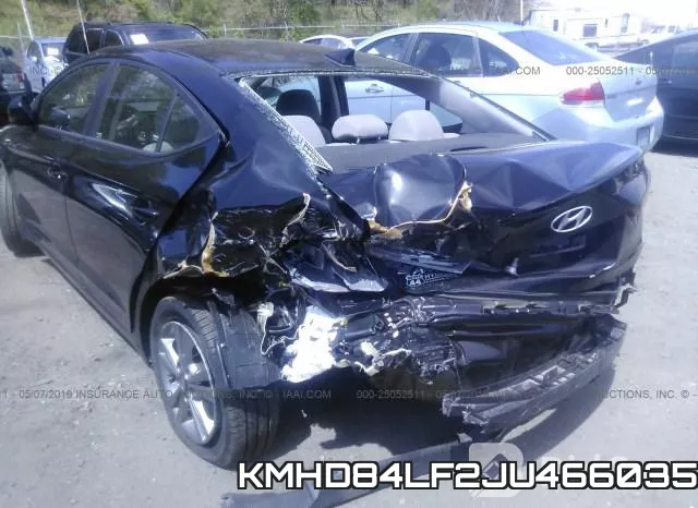 KMHD84LF2JU466035 фото 7
