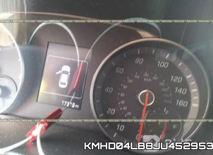 KMHD04LB8JU452953 фото 8