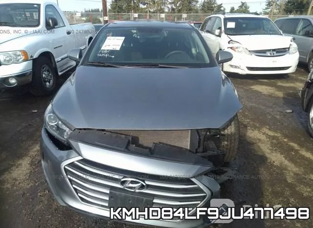 KMHD84LF9JU477498 фото 7