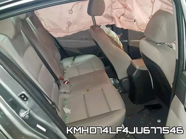 KMHD74LF4JU677546 фото 7