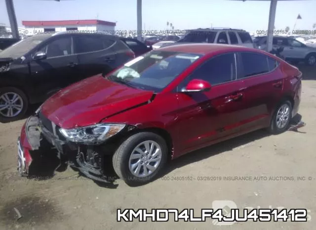 KMHD74LF4JU451412 фото 3