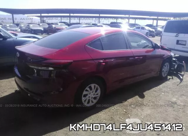 KMHD74LF4JU451412 фото 5