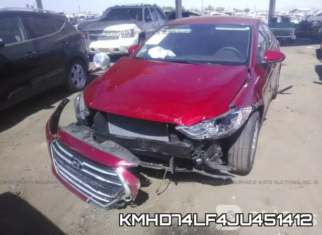 KMHD74LF4JU451412 фото 7
