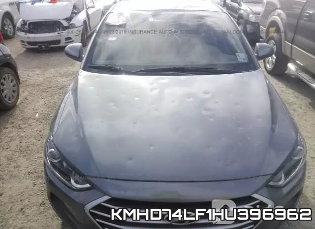 KMHD74LF1HU396962 фото 7