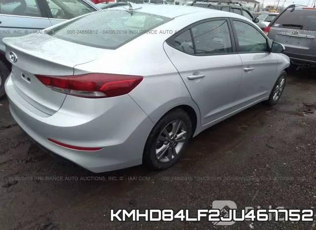 KMHD84LF2JU467752 фото 4