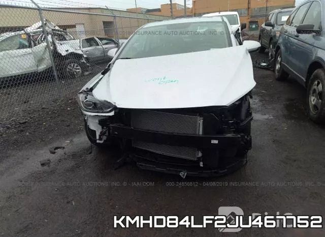 KMHD84LF2JU467752 фото 6