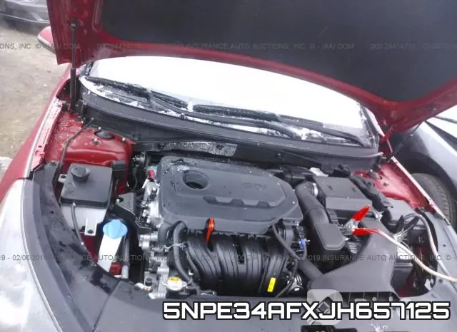5NPE34AFXJH657125 фото 2