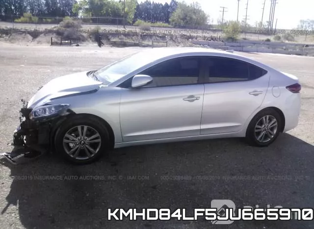 KMHD84LF5JU665970 фото 3