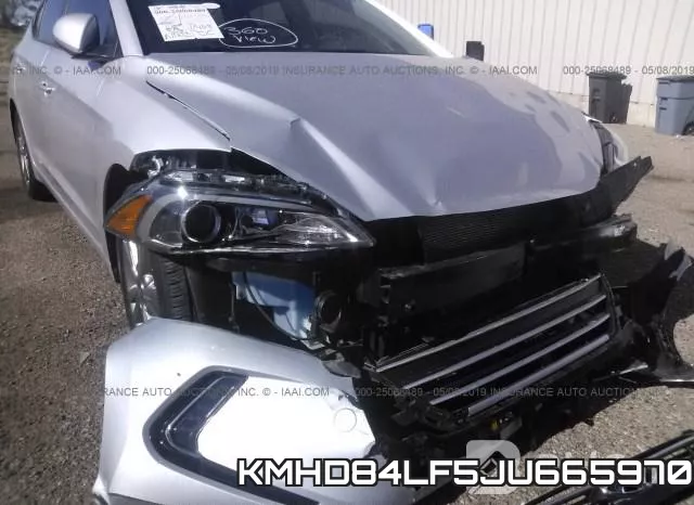 KMHD84LF5JU665970 фото 7