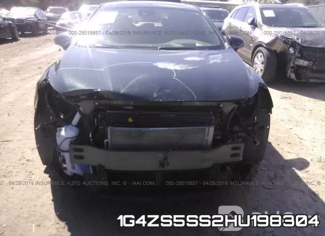 1G4ZS5SS2HU198304 фото 7