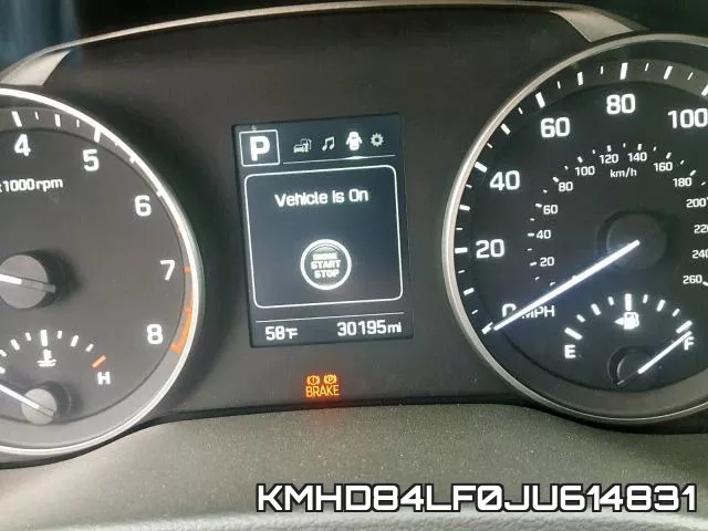 KMHD84LF0JU614831 фото 9