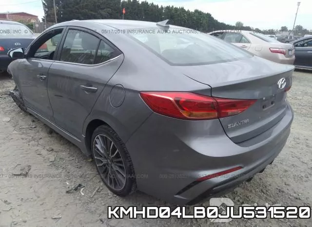 KMHD04LB0JU531520 фото 4