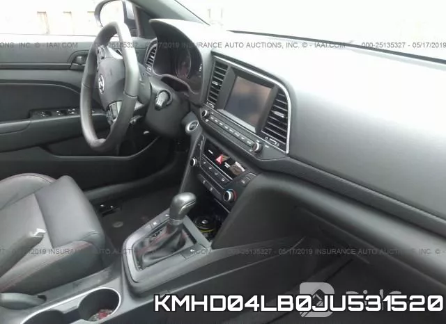KMHD04LB0JU531520 фото 6