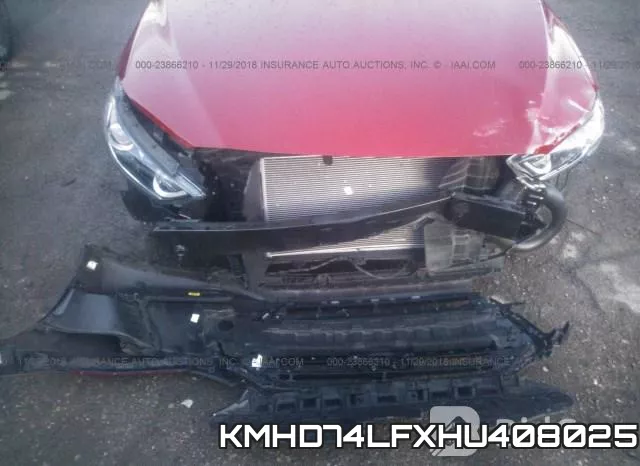 KMHD74LFXHU408025 фото 7