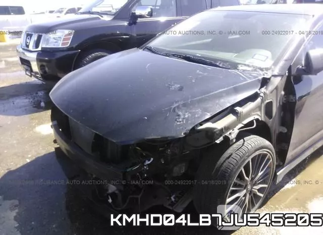 KMHD04LB7JU545205 фото 7