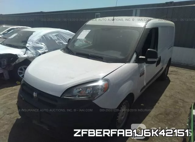 ZFBERFAB1J6K42151 фото 3