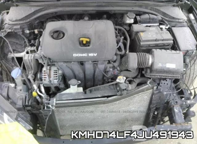 KMHD74LF4JU491943 фото 2