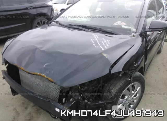 KMHD74LF4JU491943 фото 7