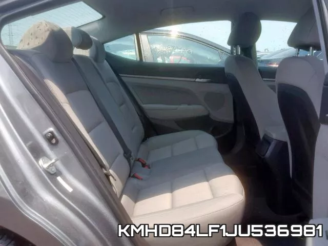 KMHD84LF1JU536981 фото 7