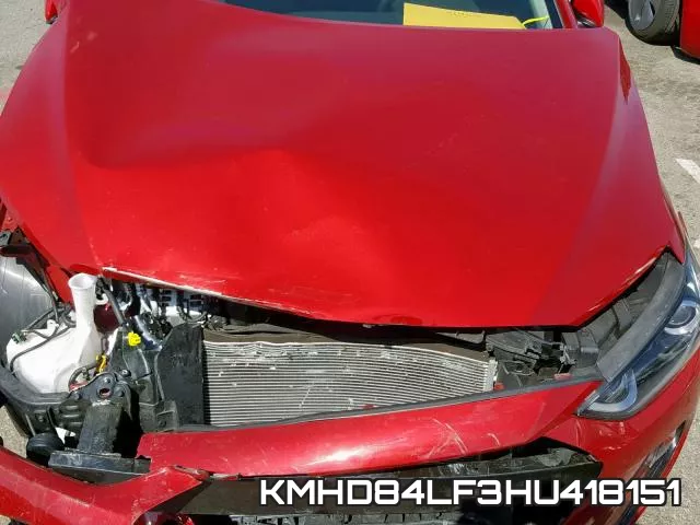 KMHD84LF3HU418151 фото 8