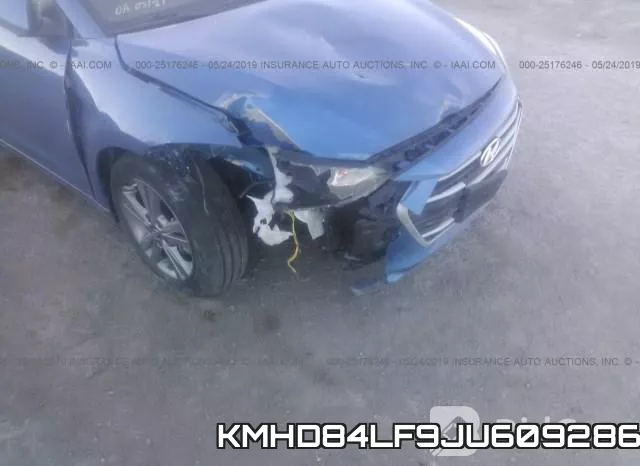KMHD84LF9JU609286 фото 7
