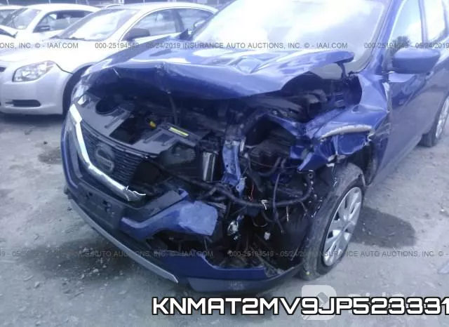 KNMAT2MV9JP523331 фото 7