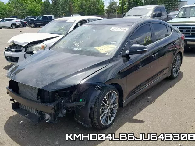 KMHD04LB6JU648308 фото 3
