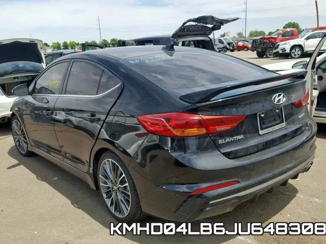 KMHD04LB6JU648308 фото 4