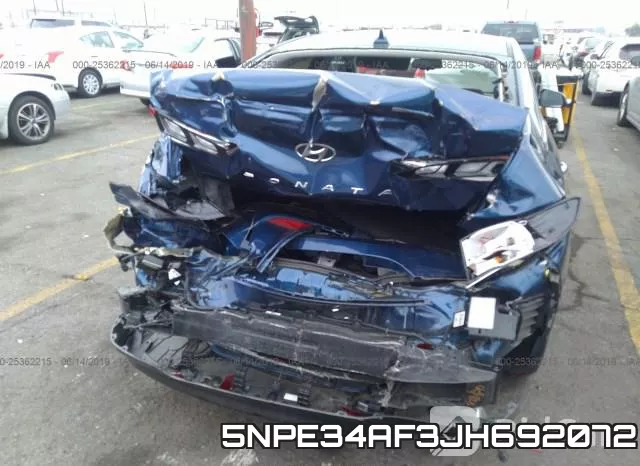 5NPE34AF3JH692072 фото 7