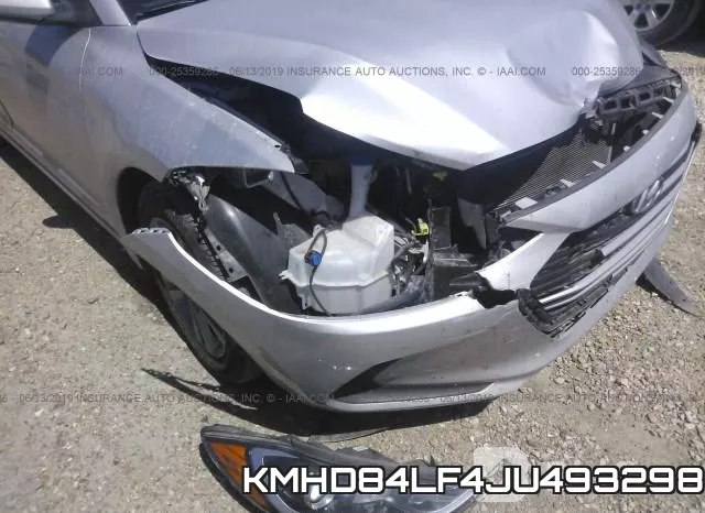 KMHD84LF4JU493298 фото 7