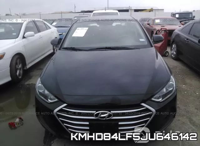 KMHD84LF5JU646142 фото 7