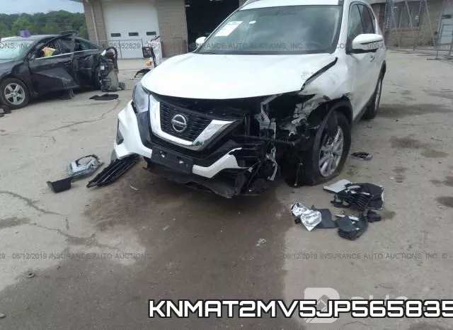 KNMAT2MV5JP565835 фото 7