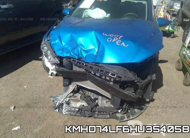 KMHD74LF6HU354058 фото 6