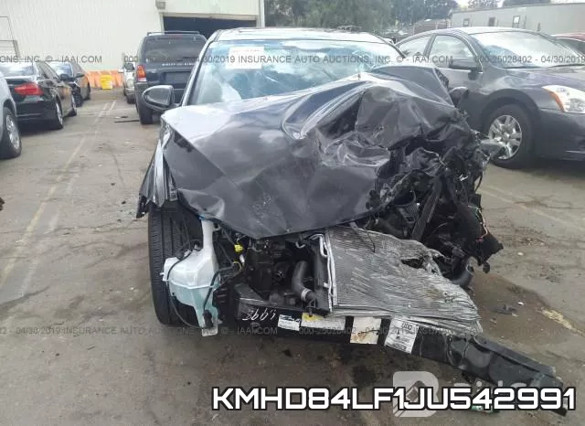 KMHD84LF1JU542991 фото 7